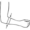 bort 122500 Size 2 Skin EpiContur Bandage with 2 Pads