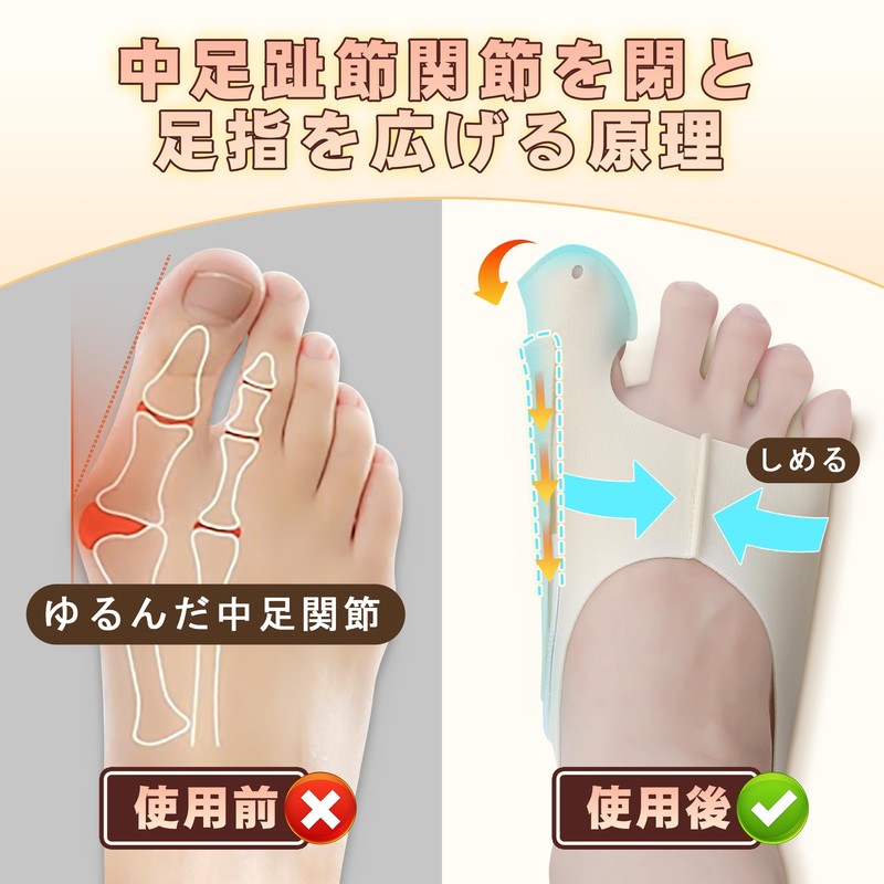 「強度調整可,二足入」KTQUICK 外反拇指サポーター 薄型 靴下タイプ 足親指を広げる 足親指サポーター 靴が履ける 洗える（Mー足長22ｃｍ～24.5ｃｍ）