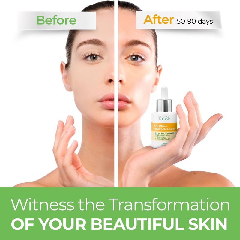 Caresilk Propolis Serum - Face Hydrating Serum - Niacinamide, Hyaluronic
