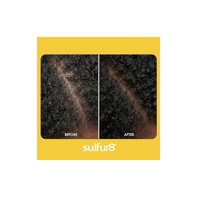 Acondicionador Sulfur8 medicado regular, fórmula anticaspa para cabello y cuero