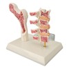 Osteoporosis Spine Model for Teaching and Demonstration, Visualize Bone Density