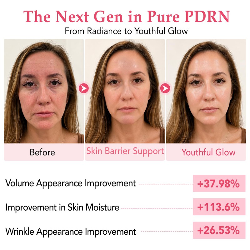 PDRN Glow Ampoule, Pink Vitamin B12 for Radiant Glass Skin,