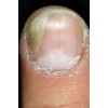 Vité 20 Crema Antihongos (12 Piezas)