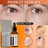 Vitamin C Facial Serum Essence, Hyaluronic Acid Serum, Hydration, Skin
