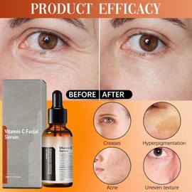 Vitamin C Facial Serum Essence, Hyaluronic Acid Serum, Hydration, Skin Moisturized, 30ml