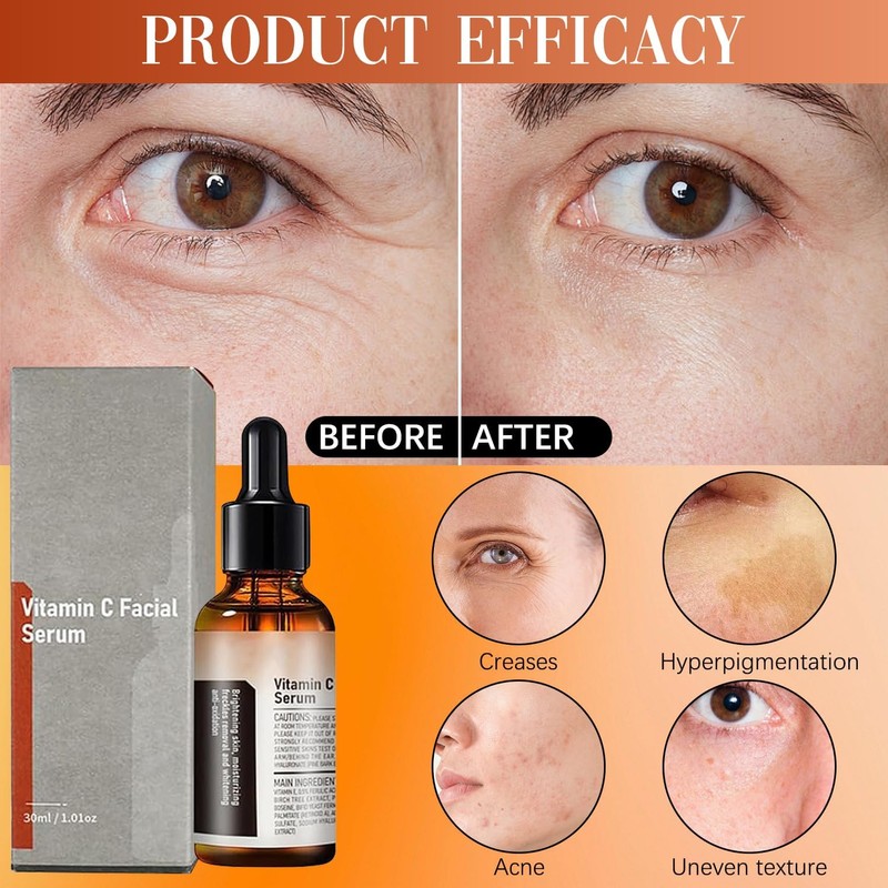 Vitamin C Facial Serum Essence, Hyaluronic Acid Serum, Hydration, Skin