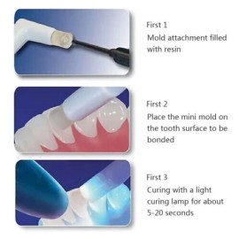 Dental Orthodontic Mould Starter Kit Mini Forming Mold Accessories Injection