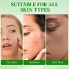 atnayo 10 Pcs Aloe Vera Moisturizing Face Mask, Skincare Hydrating