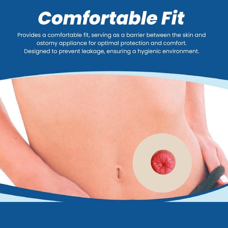 5Pcs Ostomy Barrier Ring Leakage Proof Versatile Ostomy Barrier Extender