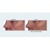 Nakery Beauty Lift-TOX 360 Firming Eye Lift Treatment Cream 1.01