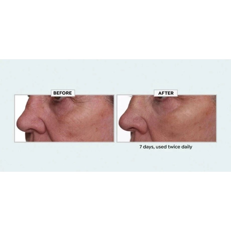 Nakery Beauty Lift-TOX 360 Firming Eye Lift Treatment Cream 1.01