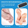 4 Pieces Foot File Replacement Rollers, Electric Foot Grinder Replacement