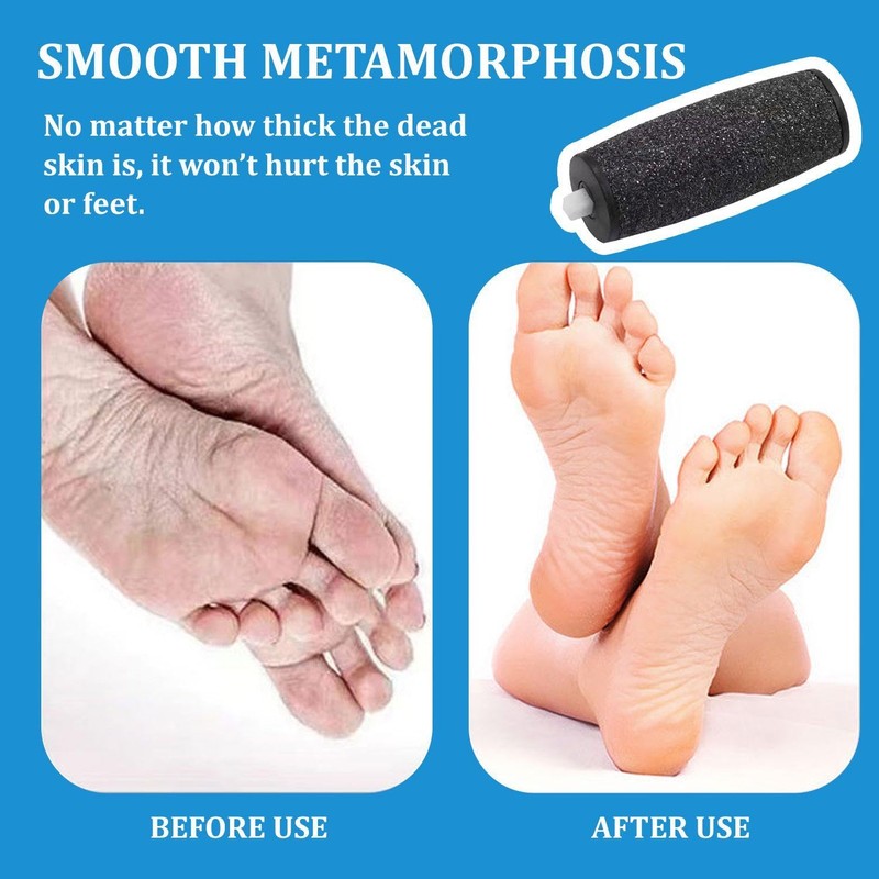 4 Pieces Foot File Replacement Rollers, Electric Foot Grinder Replacement