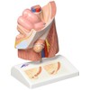 3B Scientific Human Anatomy - Hernia Model + Free Anatomy