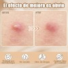 🔥 432pzs parches estrella star anti acne espinillas granos Vitaminas