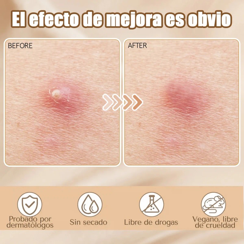 🔥 432pzs parches estrella star anti acne espinillas granos Vitaminas