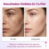 3Pzs Skin Moisturizer Crema Despigmentante Facial
