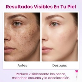 3Pzs Skin Moisturizer Crema Despigmentante Facial