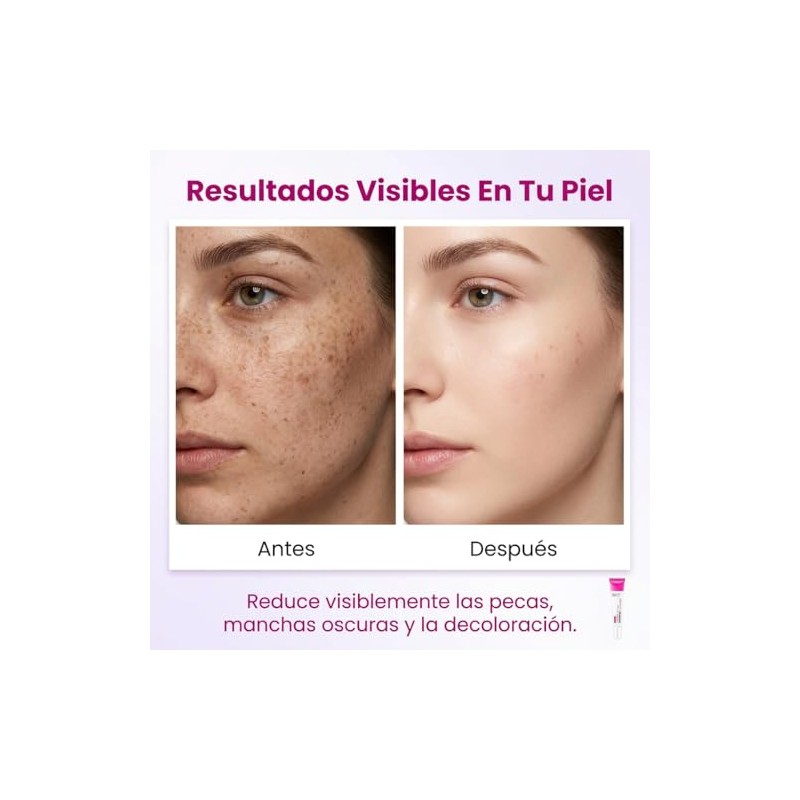 3Pzs Skin Moisturizer Crema Despigmentante Facial