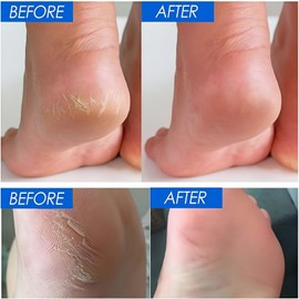 Petroleum Jelly Foot Cream,Foot Cream for Very Dry Hands & Feet,Intense Foot Repair for Cracked Heels and Dry Skin,Deeply Moisturizing Foot & Hand Balm,Heal Cream for Cracked Heels,Fo-ot Repair Cream