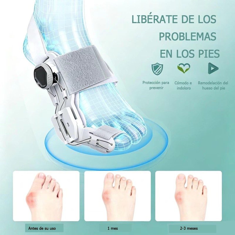 Corrector de Juanetes Para Hombre y Mujer Ajustable,Separador de Dedos
