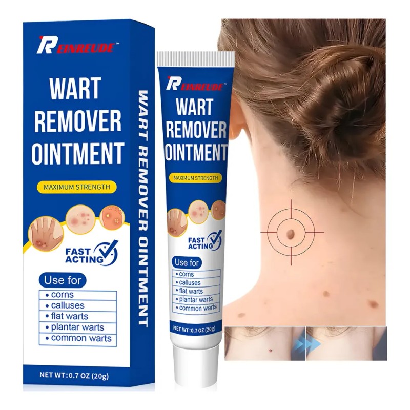 Crema Para Verrugas Elimina Eficazmente Y Cuida La Piel 20g
