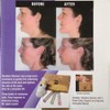HEALLILY Massager for Face and Neck with Double Chin to