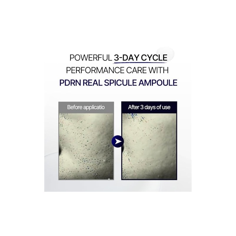 ULTIMATE REJUVENATION SPICULE AMPOULE