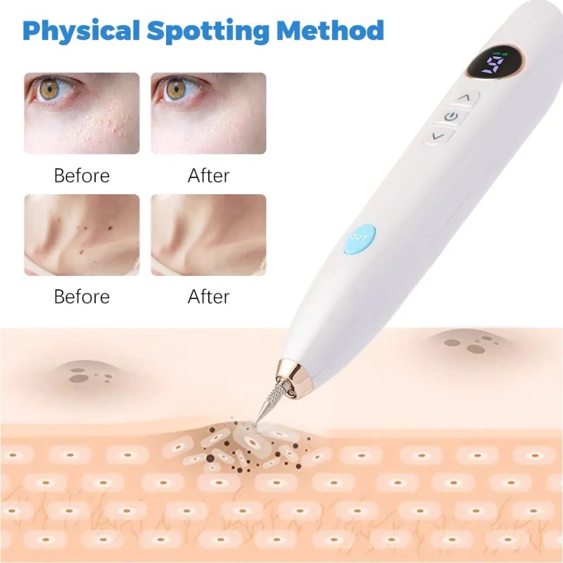Elimina Mezquinos Granos Lunares Verrugas Manchas Vph