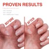 Probelle Tratamiento Fortalecedor de Uñas - Crecimiento y Acondicionamiento