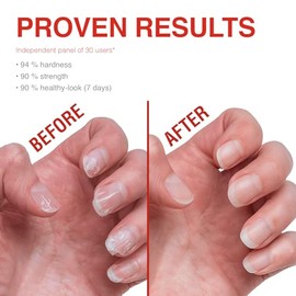 Probelle Tratamiento Fortalecedor de Uñas - Crecimiento y Acondicionamiento
