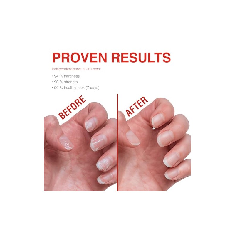 Probelle Tratamiento Fortalecedor de Uñas - Crecimiento y Acondicionamiento