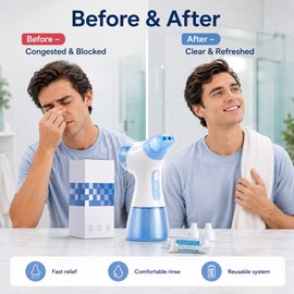 Electric Nasal Irrigation System for Daily Rinse – Rechargeable Nose Cleaner with Water Waste Tanks