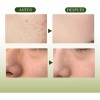 Mascarilla Oxyglow Barro Control Aceite
