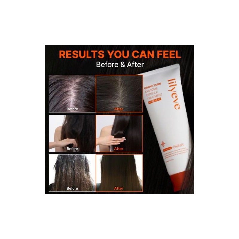 lilyeve [lilyeve]Grow:Turn Exosome Capsule Treatment 230ml