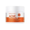 Tamoskiny Acne Face Blemish Pimple Cream Salicylic Cystic Breakout Treatment