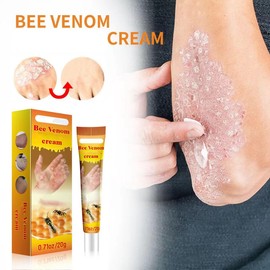 Bee Venom Cream，Bee Venom Cream for Skin, Body, Neck, Waist, Back, Hand, Feet and Leg.
