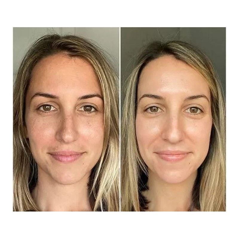 CAHNSAI Petalos De Rosa Mascarilla Humectante Aclarante Hidratacion