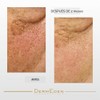 Dermeden - Crema intensa para contorno de ojos antienvejecimiento, 15