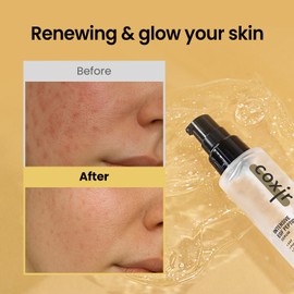 coxir INTENSIVE EGF PEPTIDES SERUM l EGF(Epidermal Growth Factor) Peptide Serum for Face – Korean Formula for Firm, Renew& Hydrated Skin – Facial Serum for Lines