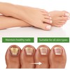 2pcs Nail Treatment for Toenails, Nail Serum, Natural Nail Strengthene,