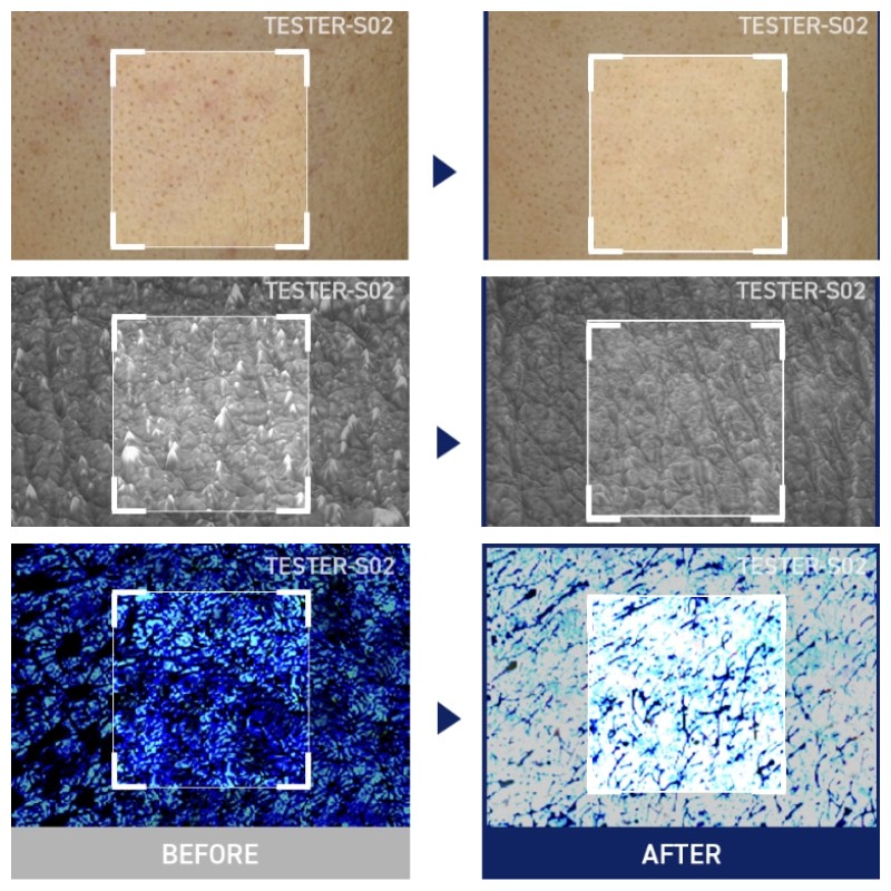 MEDIHEAL Square Toner Pads 200ea, Type:Tea Tree Trouble Pad