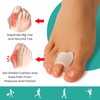 Welnove Toe Separators for Overlapping Toes - Aloe Vera Extract