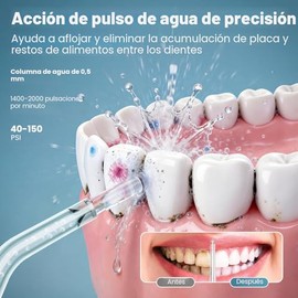 Onlyone - Irrigador dental con presión de agua ajustable para el cuidado bucal diario | Rechargeable Portable Oral Irrigator for Orthodontic & Sensiti
