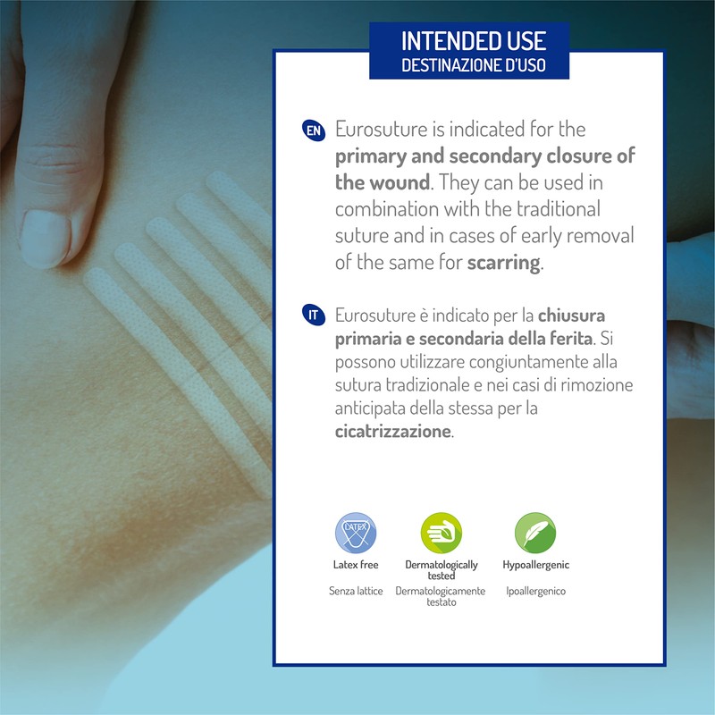 Eurosuture - Skin Closure, Hypoallergenic, Reinforced, Round Ends, 1/8 x