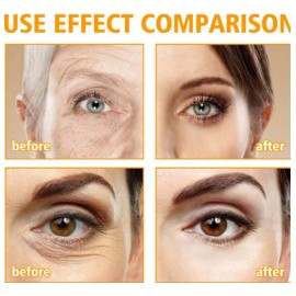 Crema Para El Cuidado De Los Ojos: Hidratante Y Rejuvenecedo