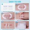 Emergency Wound Closure Strips-Repair Wounds Without Stitches&Hold Small Wound, Butterfly