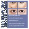 Ae Crema Hidratante Activa For El Contorno De Ojos