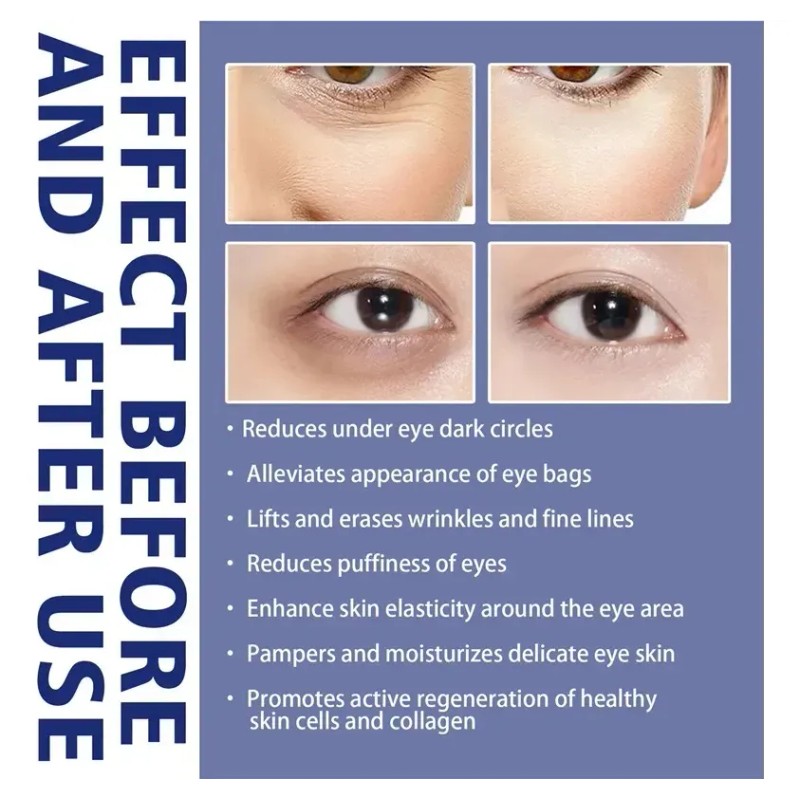 Ae Crema Hidratante Activa For El Contorno De Ojos