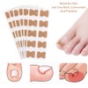 Ingrown Toenails Set, Toenail Correction, Toenail Patch, Toenail Correction Patch,